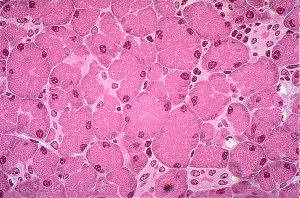 A sample of normal pancreatic tissue for use as a research control for comparison with pancreatic cancer samples. One common source of normal specimens is "normal adjacent tissue" (NAT), which may be may be included biopsied or surgically resected samples.