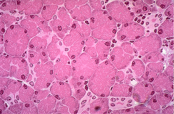 pancreas tissue specimen for research