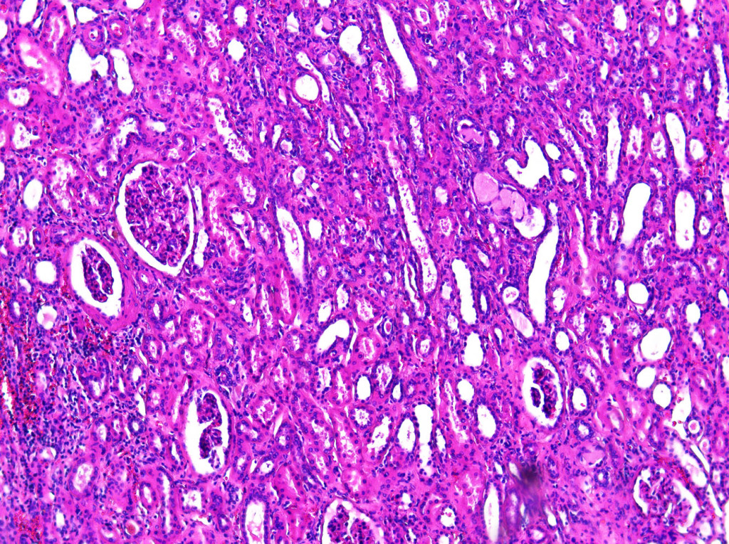 Microscope slide of normal kidney sample LabAlly